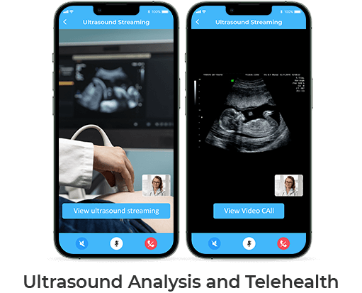 Ultrasound Analysis and Telehealth mobile